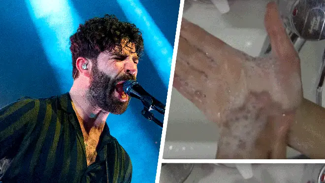 Foals frontman Yannis Philippakis with stills from their Wash Off video