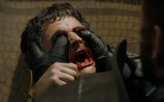 Oberyn's eyes were gouged out by Sir Gregor