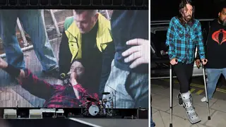Dave Grohl breaks his leg at a Foo Fighters show in Gothenburg, Sweden, June 2015